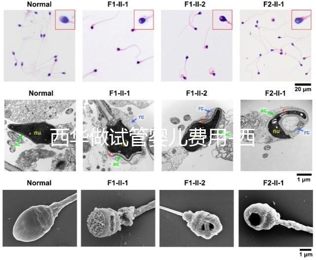西華做試管嬰兒費(fèi)用-西華醫(yī)院試管嬰兒花費(fèi)明細(xì)表