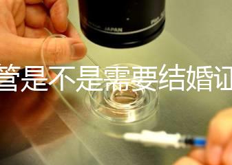 試管是不是需要結(jié)婚證,做試管是不是要結(jié)婚證